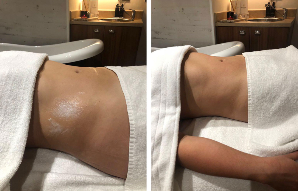 Lymphatic Drainage 6 Sessions