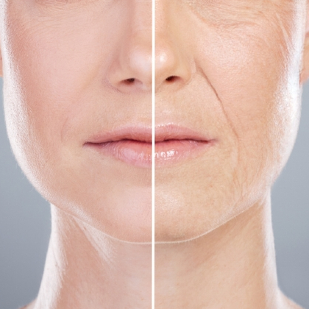 Anti-Aging Facial at Bare Beauty Esthetics in Pilot Mountain, NC