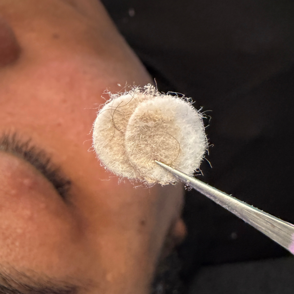 Microdermabrasion  -ADD ON at Dollcrew Skin Studios in Union, NJ