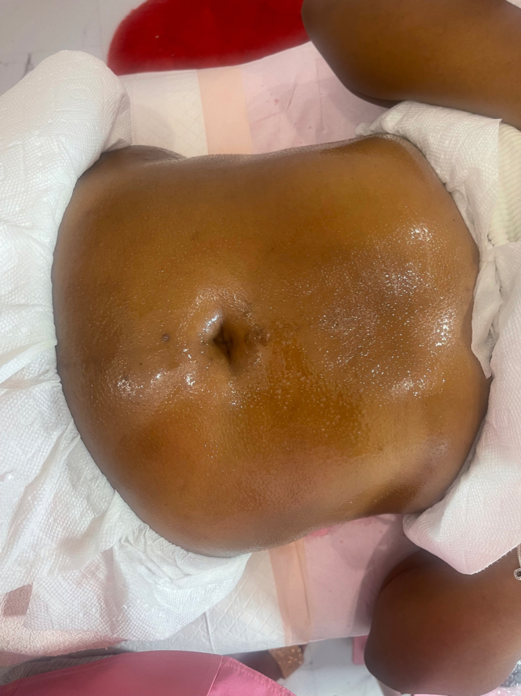 360 Body Contouring  (6 Sessions)