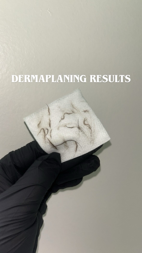 Winter Radiance Facial ⛄️❄️