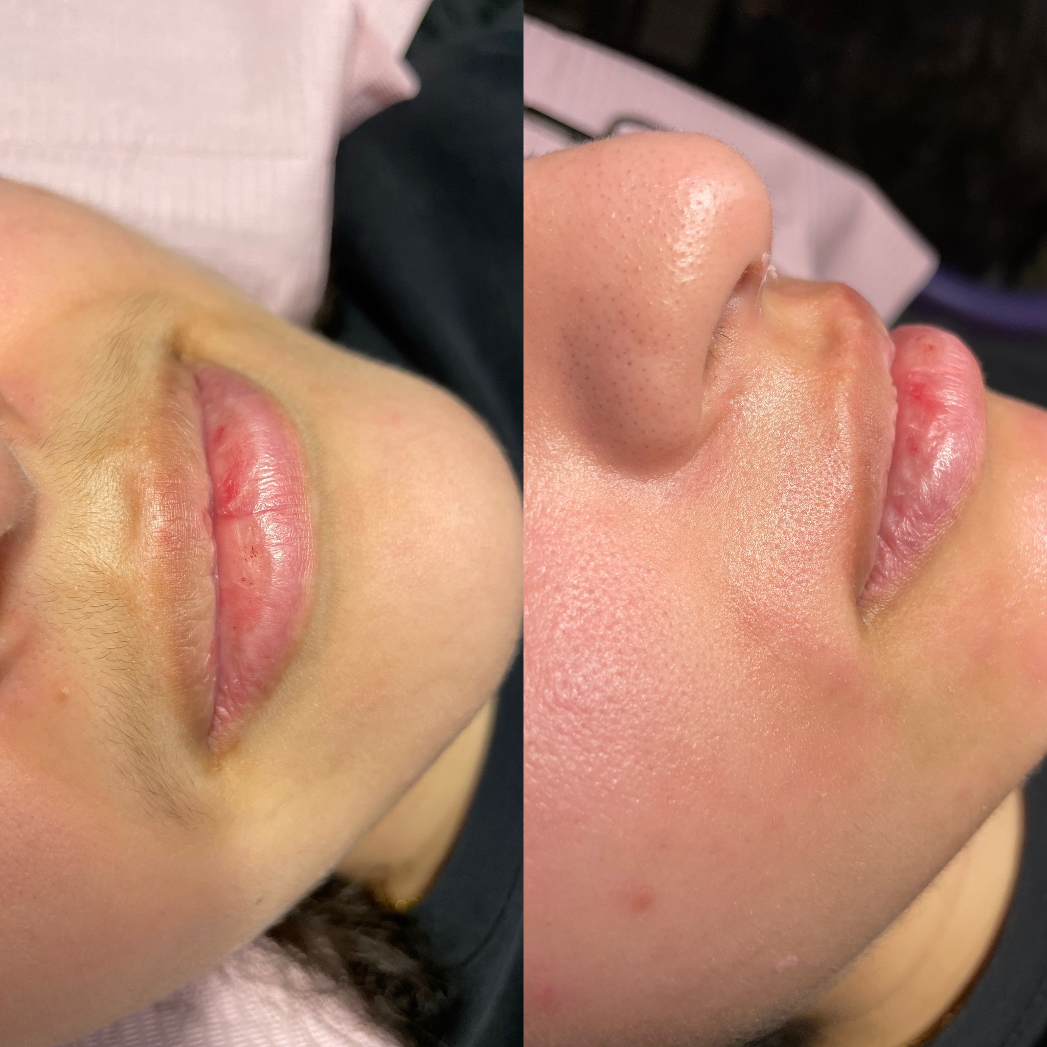 Lip Wax at Flawless By Fabiola in Baldwin, NY