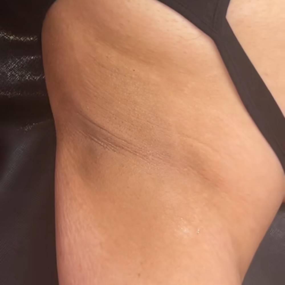 Content Underarm at QueenBeeGlam in Arlington, TX