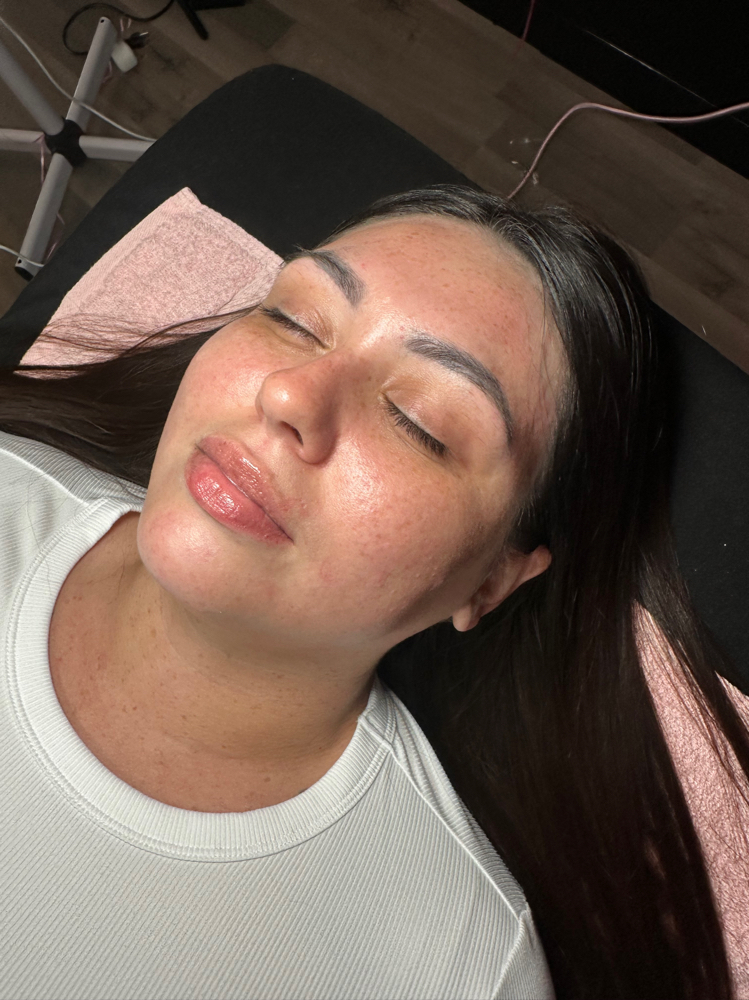 The Glow Facial ✨