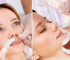 Facial Waxing