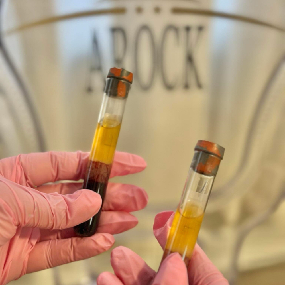 PRP at ARock Beauty & Wellness in San Angelo, TX