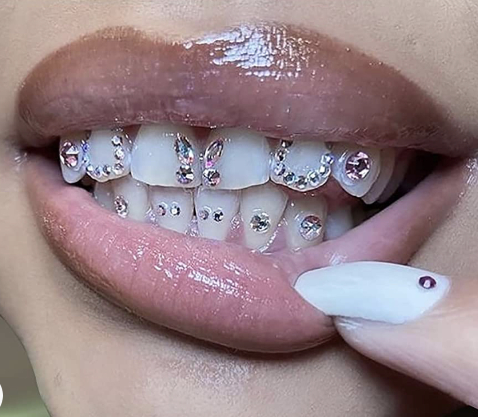 Tooth Gems (2-4)