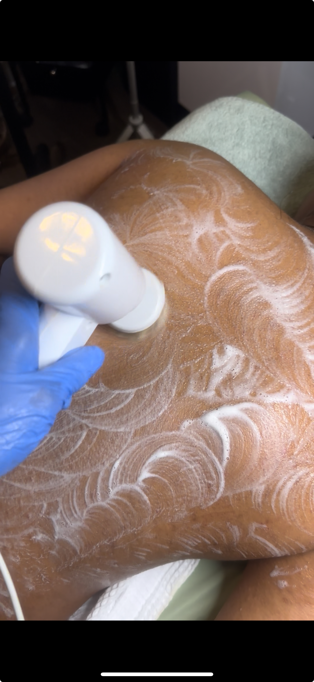 Back-to-Clarity Treatment