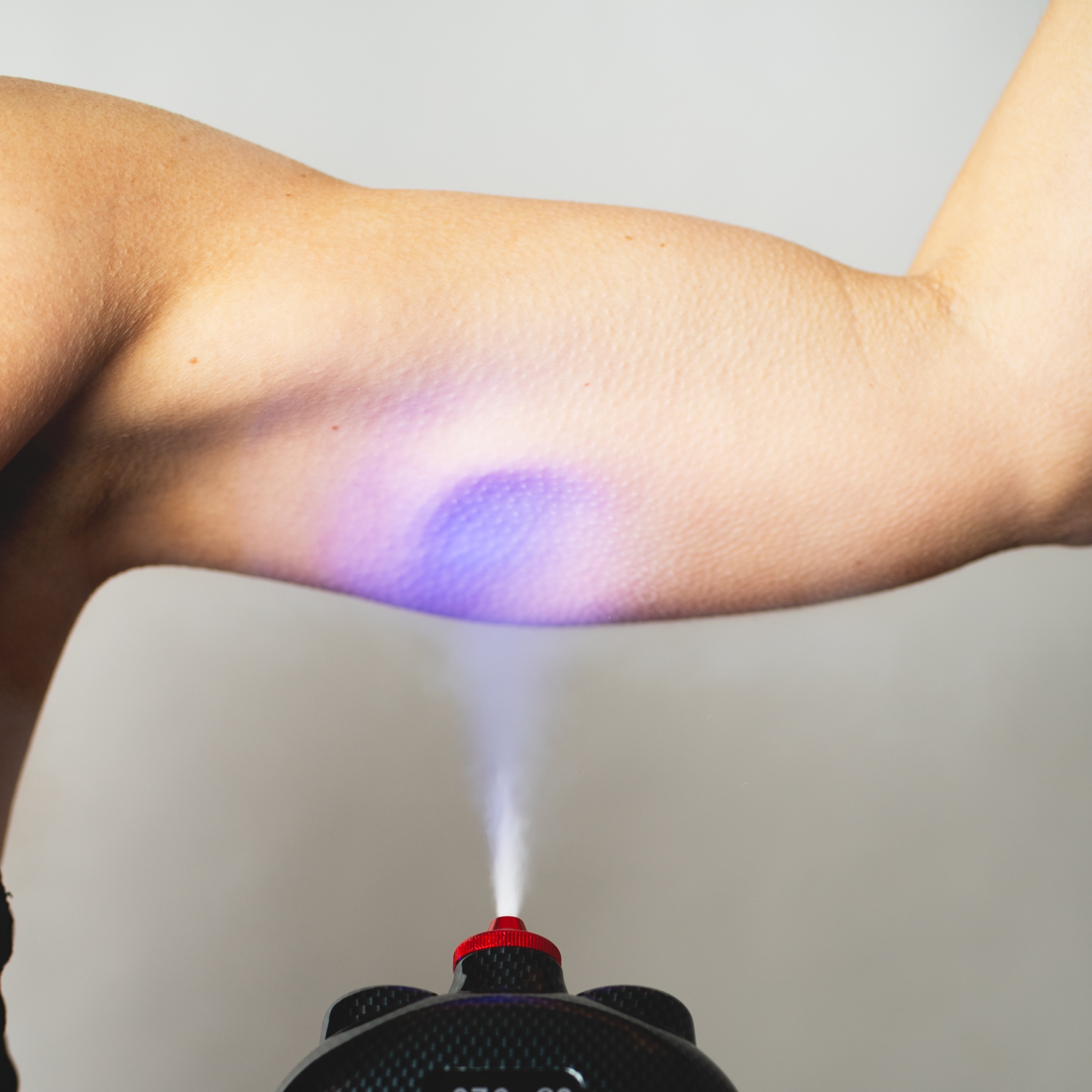 Arm Sculpt Cryotherapy