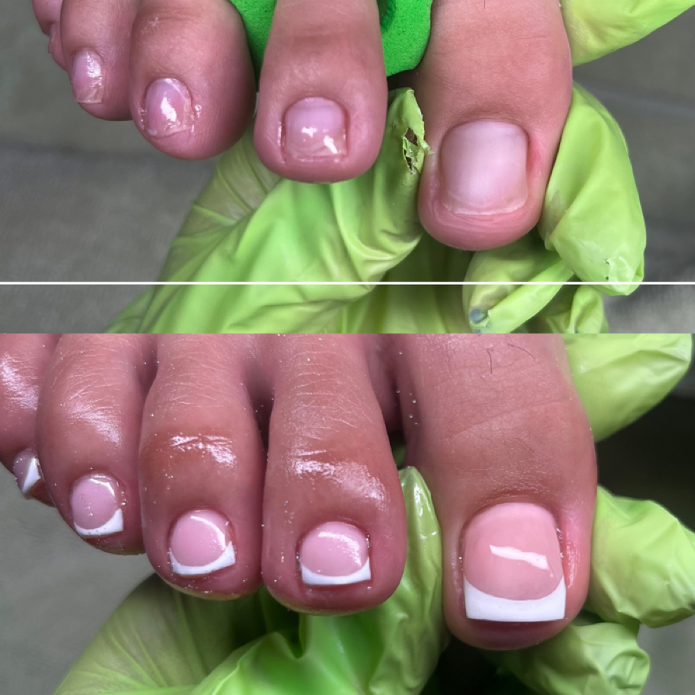 Toe BBL🍑 Toe Nail Reconstruction at Empress Beauty Lounge in Cherry Valley, IL