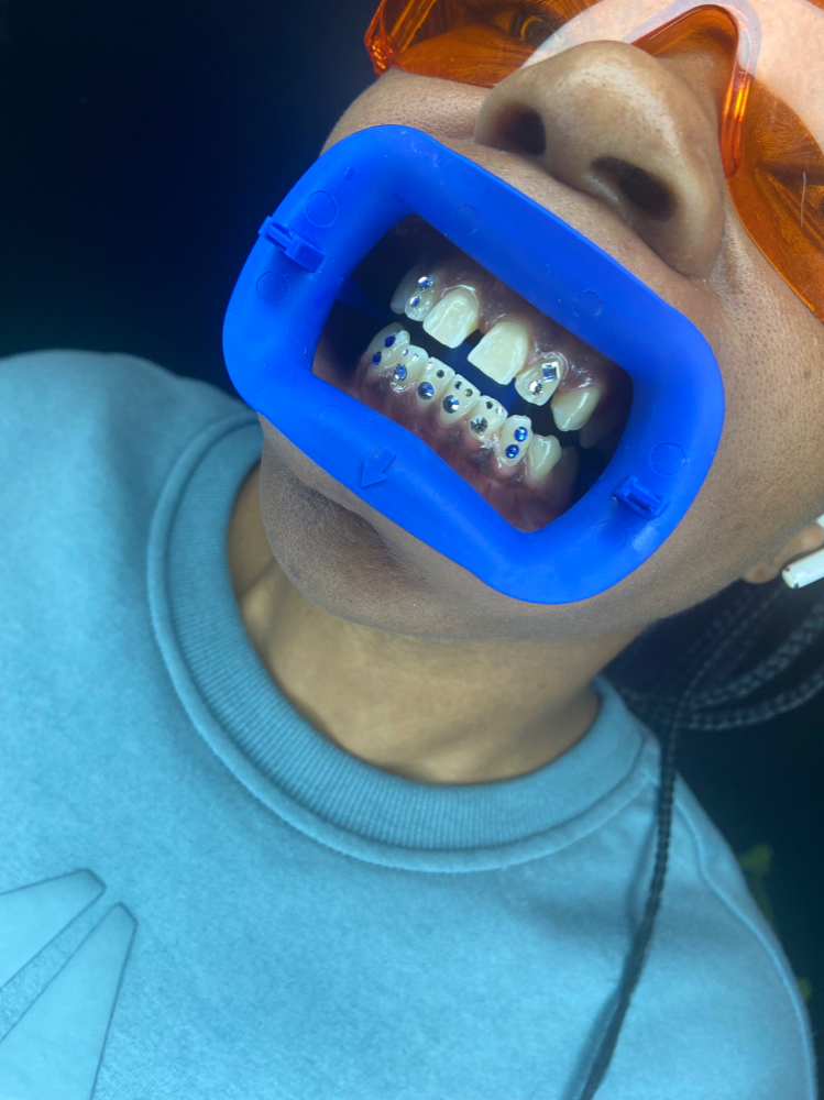 Icy Grill