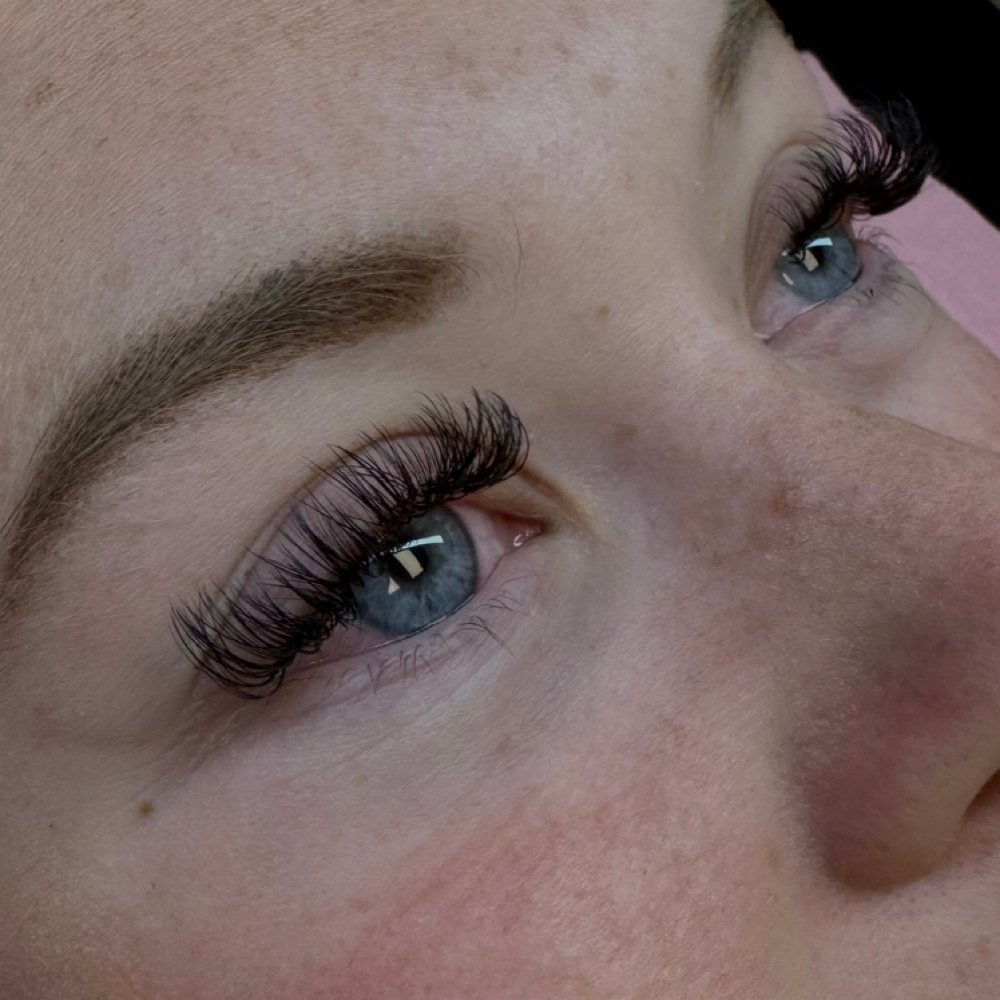 Hybrid/Light Volume Fill Options at Esthetic Glow in arlington, WA