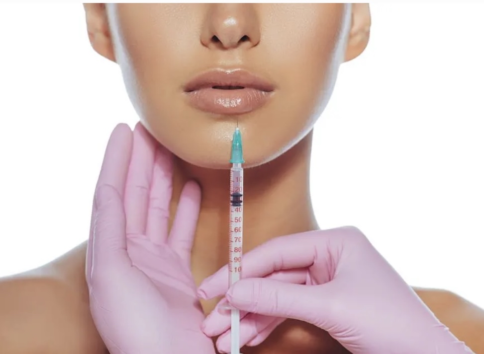 Lip Filler