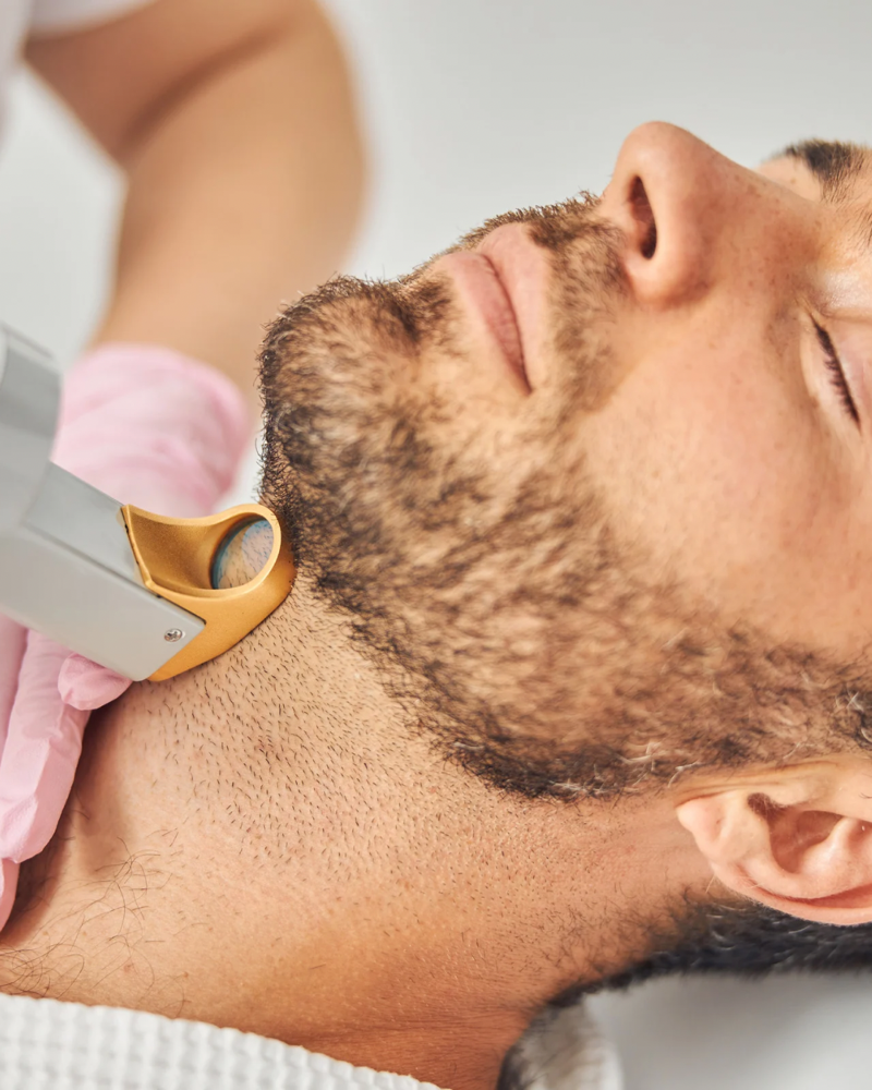 Full Neck Laser Hair Removal at M.A.V Aesthetics in Fort Morgan, CO
