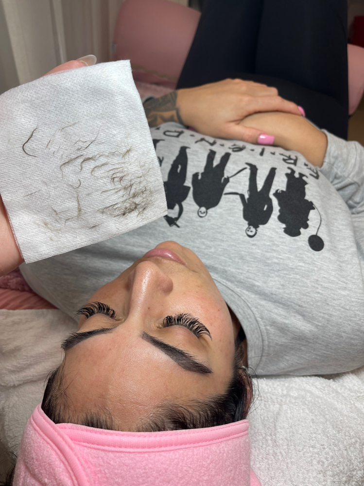 Dermaplaning Treatment