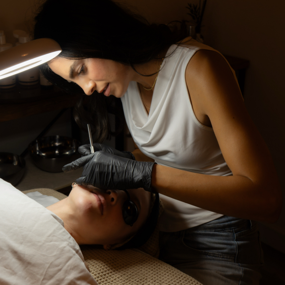 Acne Bootcamp Treatment at The Skin Clear Studio in Oceanside, CA