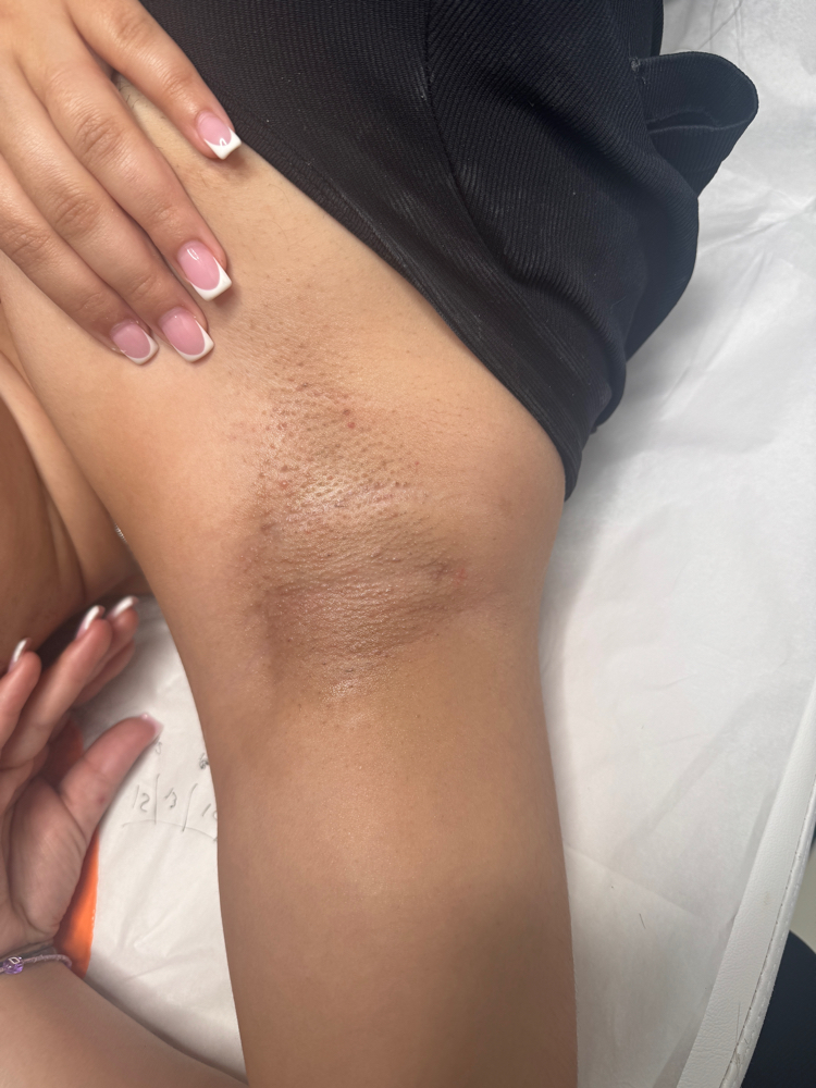 Underarm Wax at EyeDeal Beauty Co in Laurelton, NY