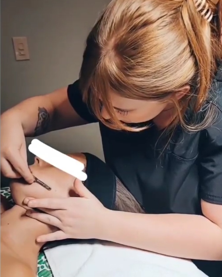 Dermaplaning Facial