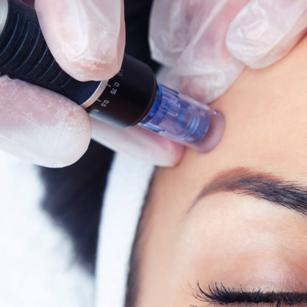 Nano Infusion Facial at Esthetics by Ashlee in Yucaipa, CA
