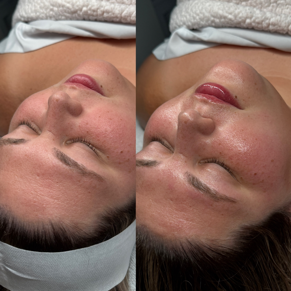 O2 Luminance Boost