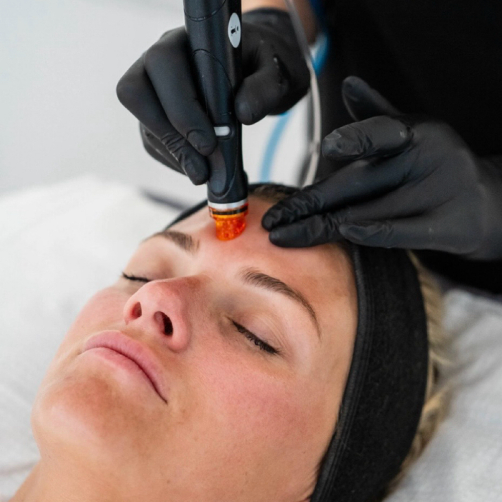 Copper Peptide HydraFacial at Hefe Ladies, LLC in Tempe, AZ