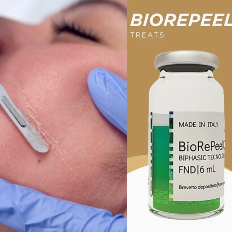 BioRePeel CL3 + Dermaplane