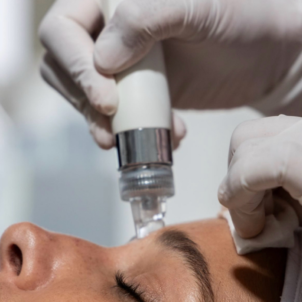 HydroFacial at The Face Lounge by Blair in Columbia, MS
