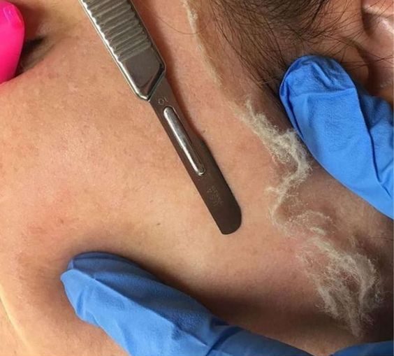 Dermaplaning Luxury Facial at Jennifer Marie Skincare in Elkhart, IN