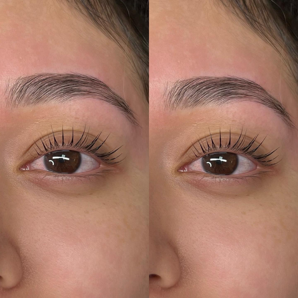 Lash Lift