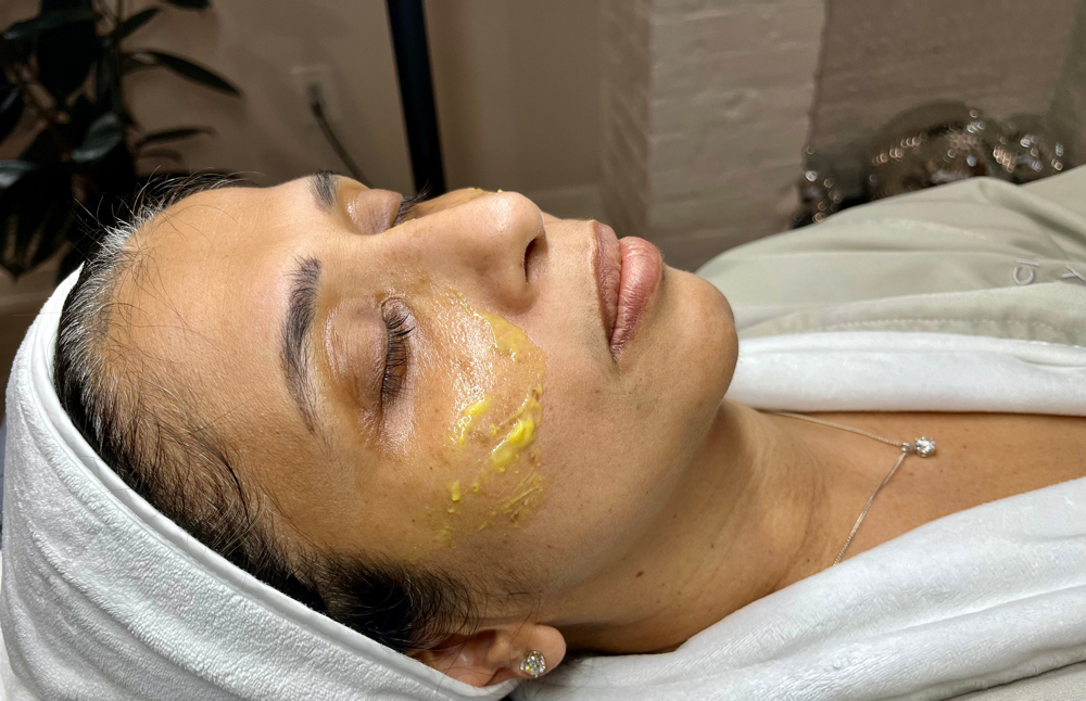 Multi-Precision Peel