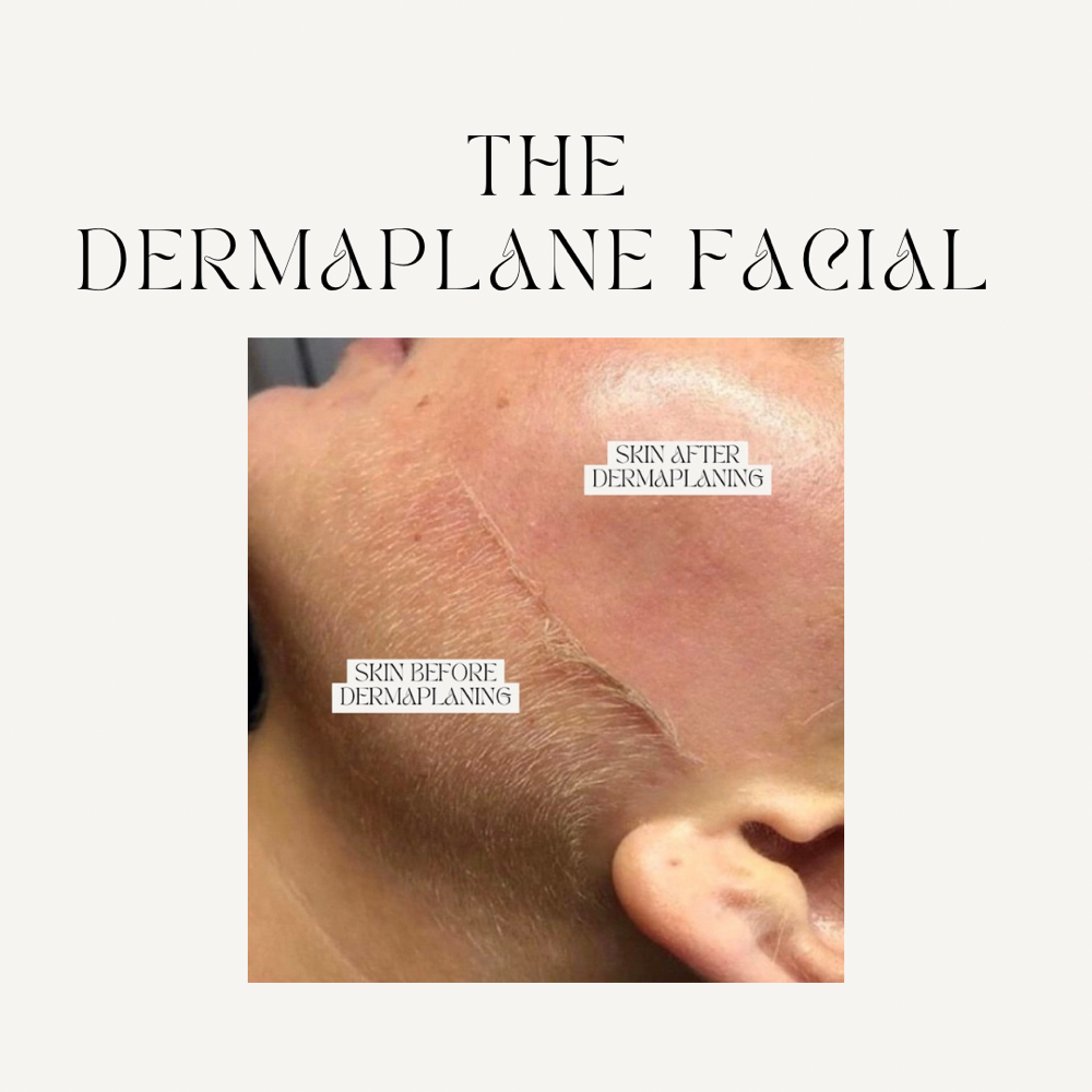 dermaplane facial