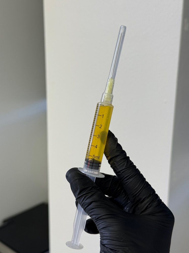PRF Injections at Aether Aesthetics in Midland, TX