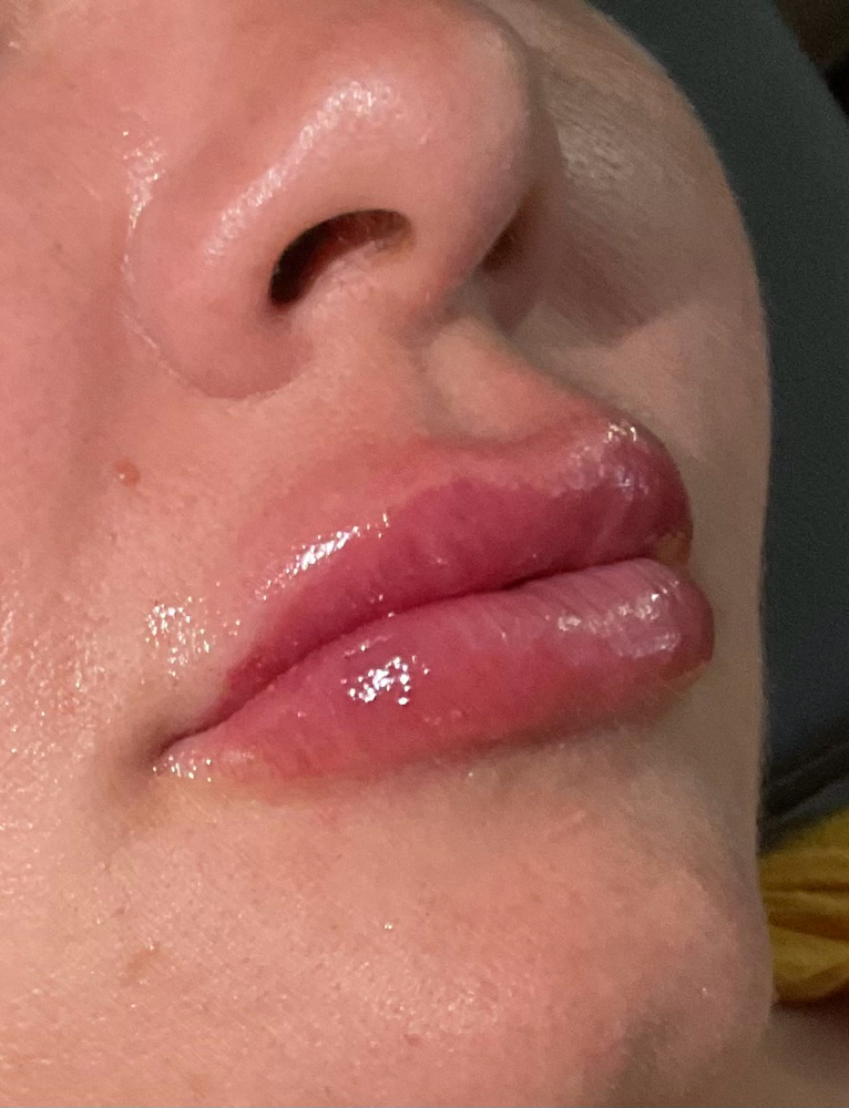 1.5ml Lip Tint at Punchy Pouts & Esthetics in Amarillo, TX