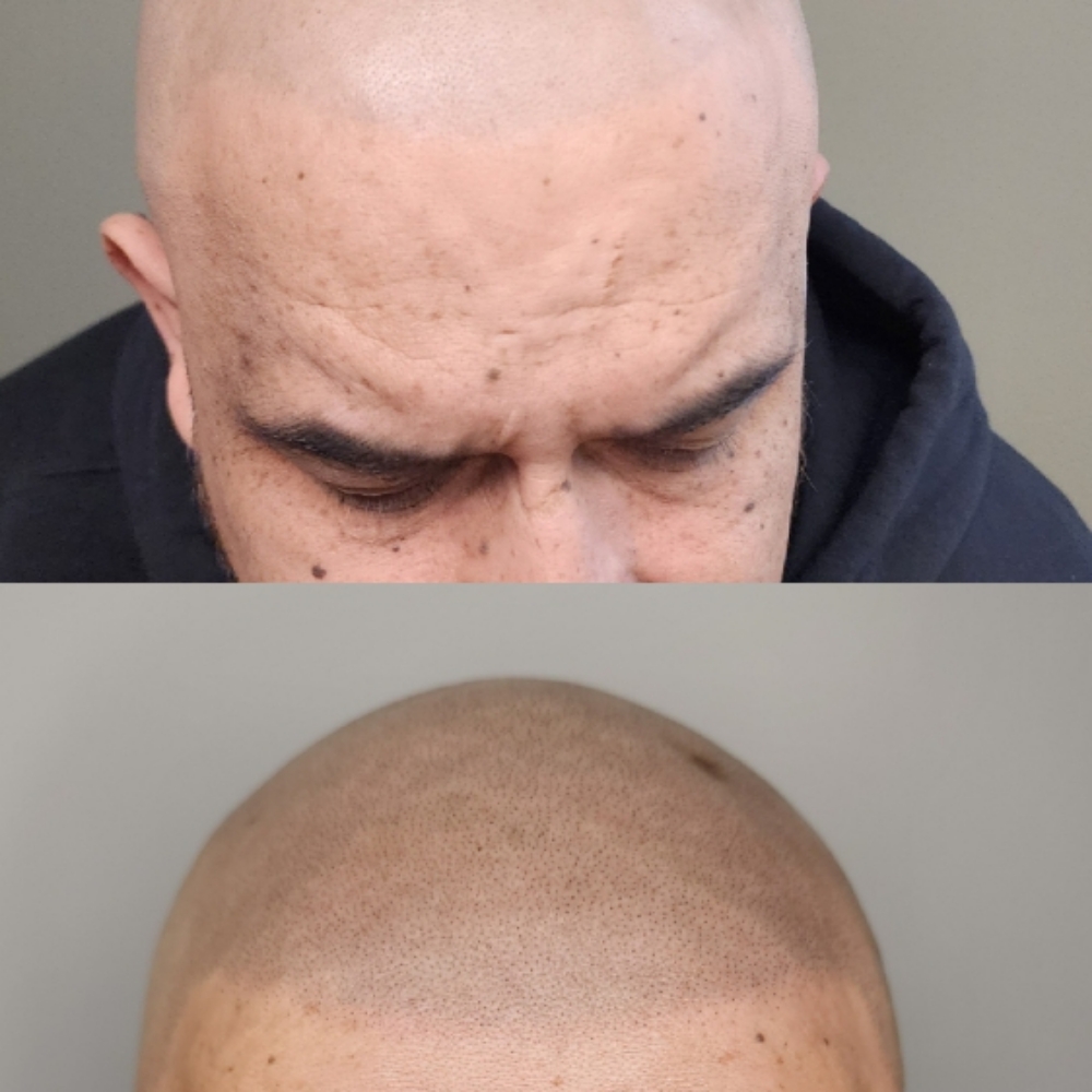 Scalp Micropigmentation Refresh Ses at Lumi Ink Studio PMU & SMP in Bartlett, IL