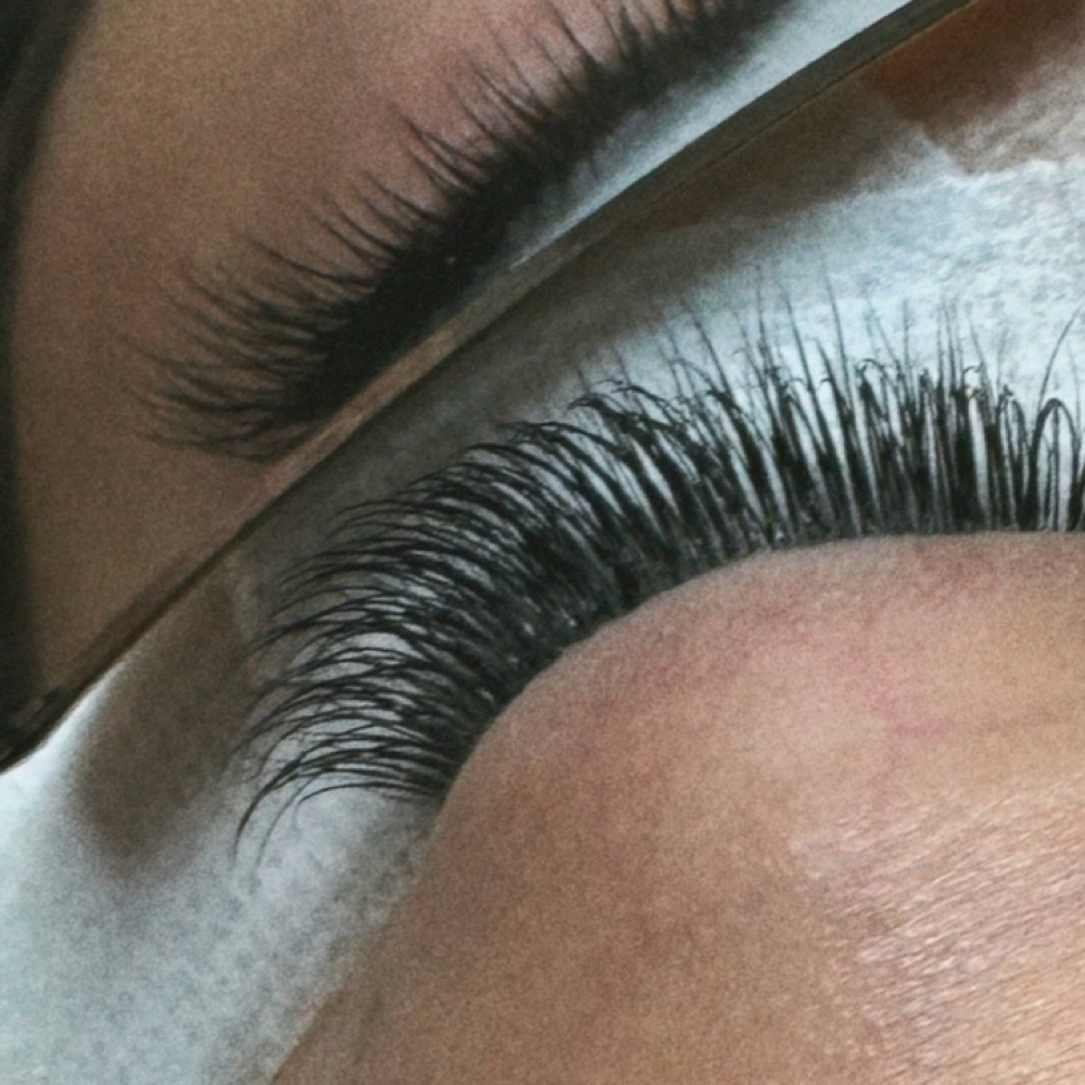 Clean Girl Fill at Little Beauty Clinic in Bonita, CA
