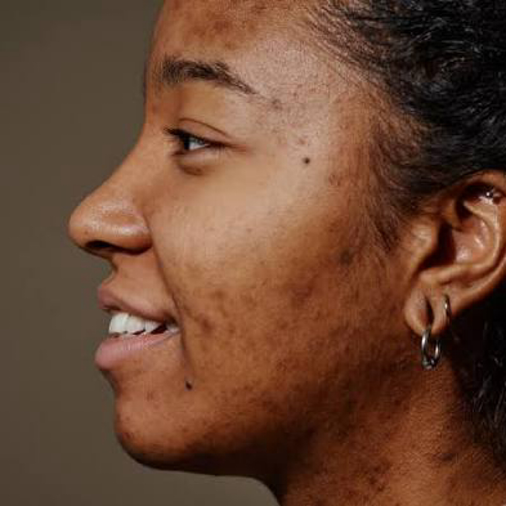 Even & Correct at Skin by Cydni in Atlanta, GA