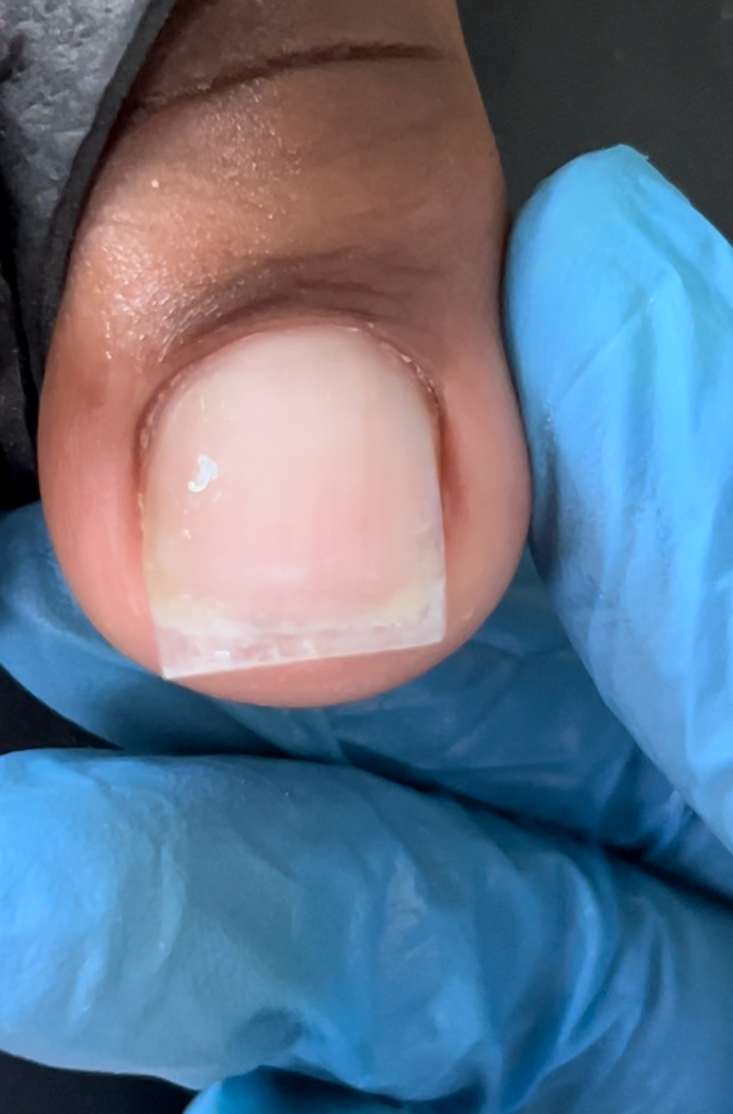Big Toe Nail Extension (Add On)