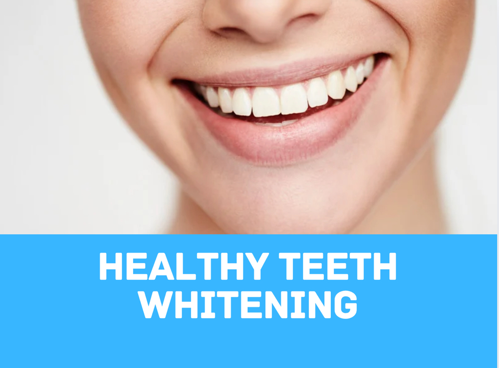 Laser Teeth Whitening Maintenance