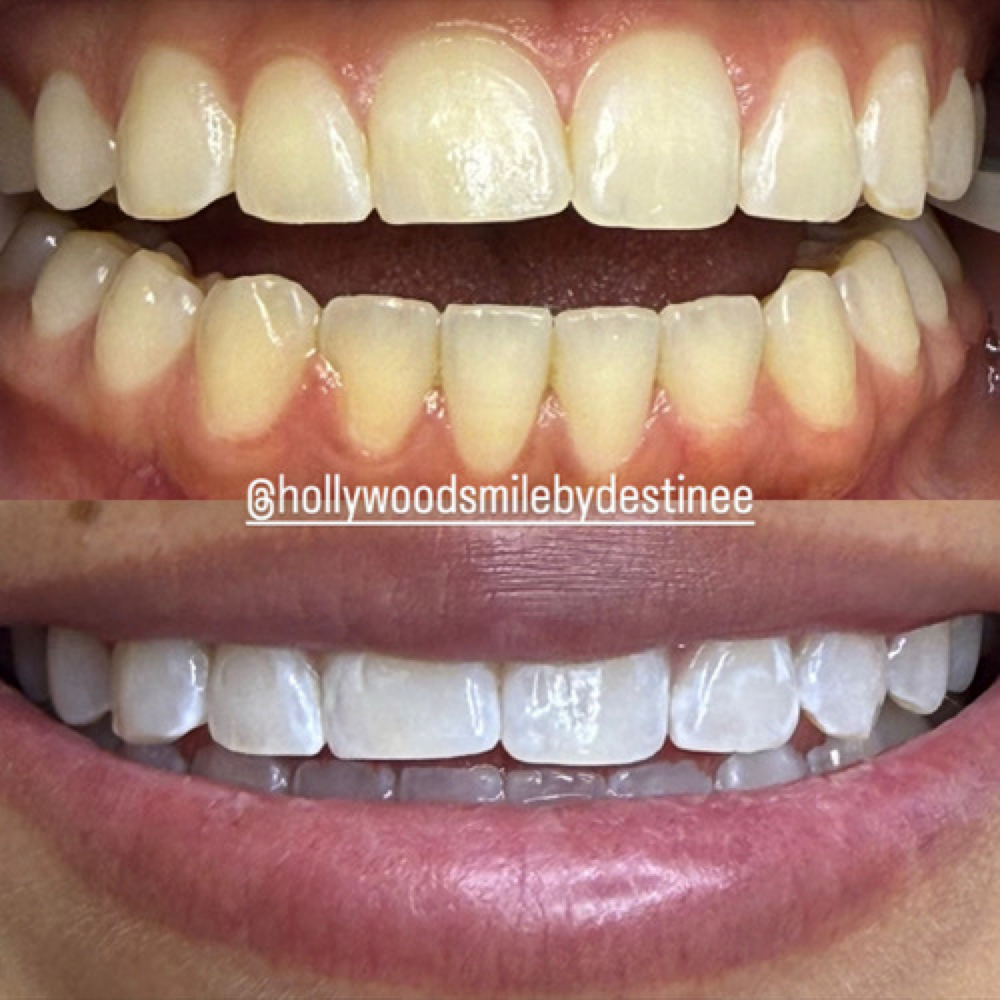 Glam White✨ 4-6 Shades at Queen Of The Mouth in San Antonio, TX