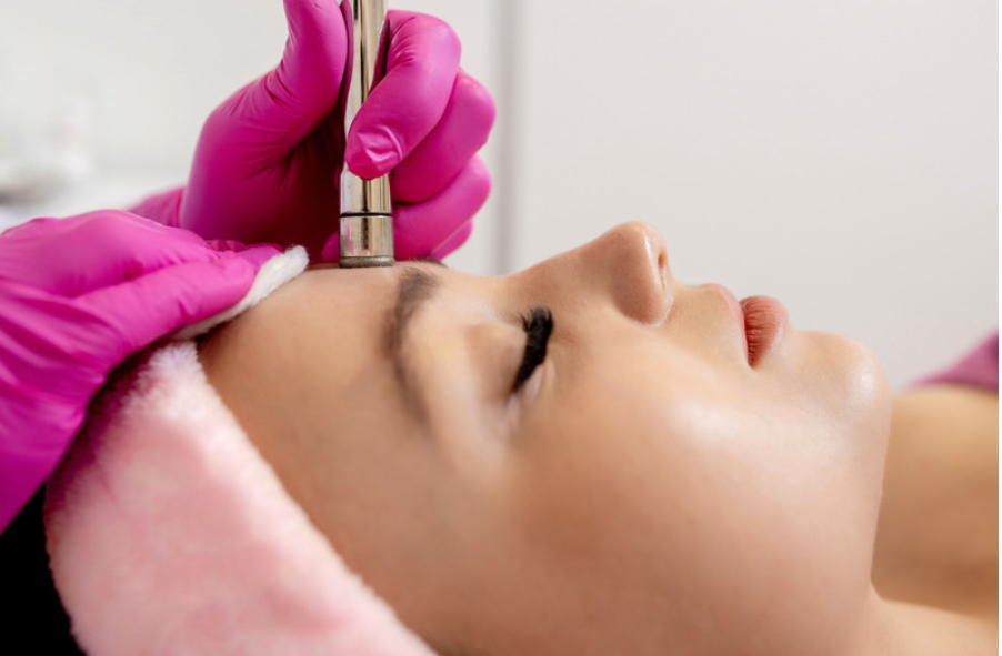 Microdermabrasion