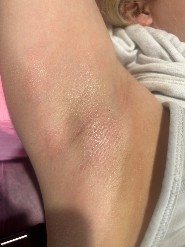 Underarm Wax