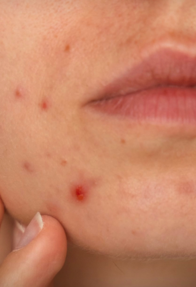 Repair & Relief Facial