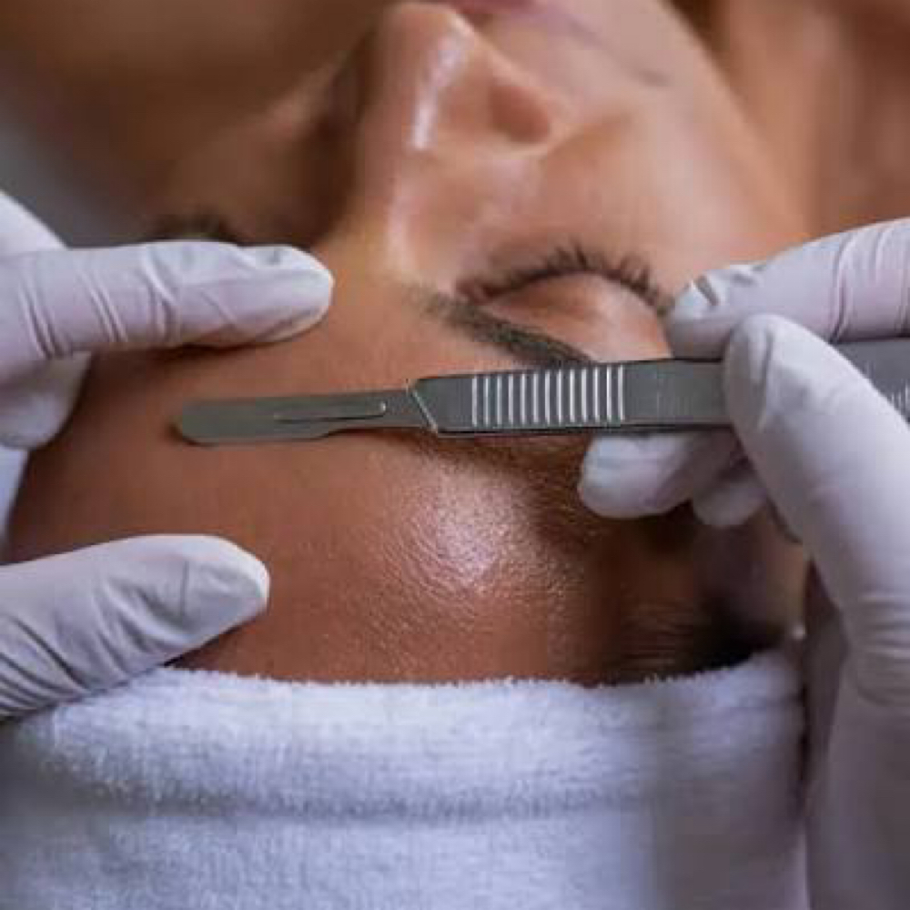 Dermaplaning Treatment at UIB Tattoos & Esthetics LLC in Anchorage, AK