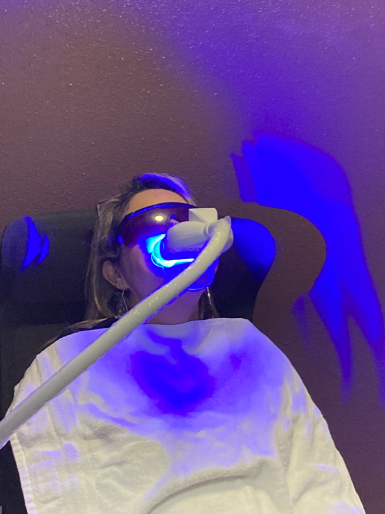 Teeth whitening