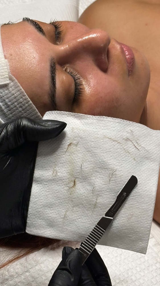 Facial Con Dermaplaning