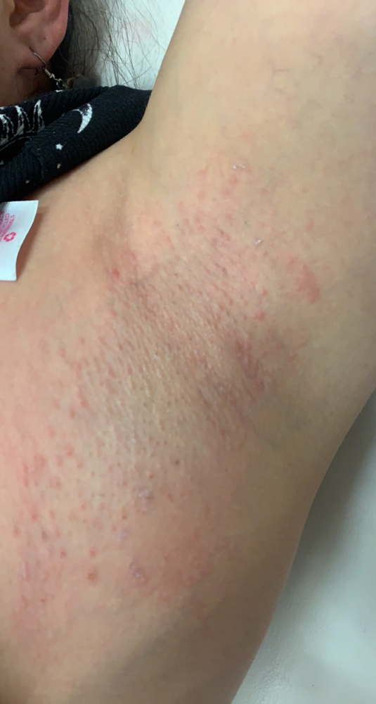 Armpit Waxing