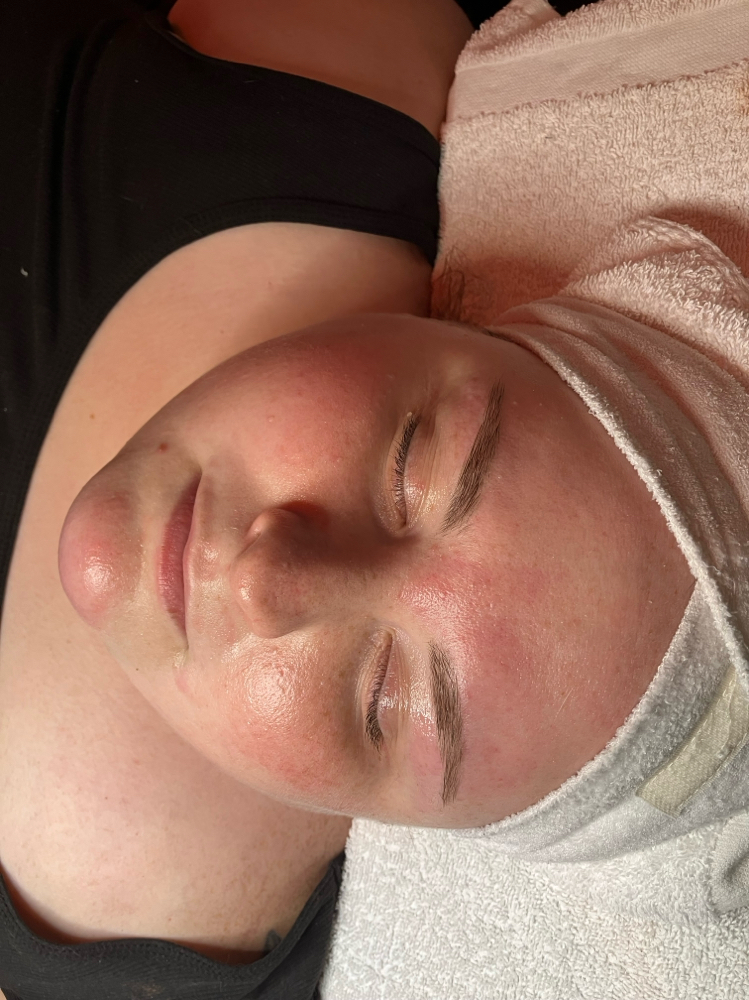 60 Min Facial at It Girl Esthetics in Greenacres, FL