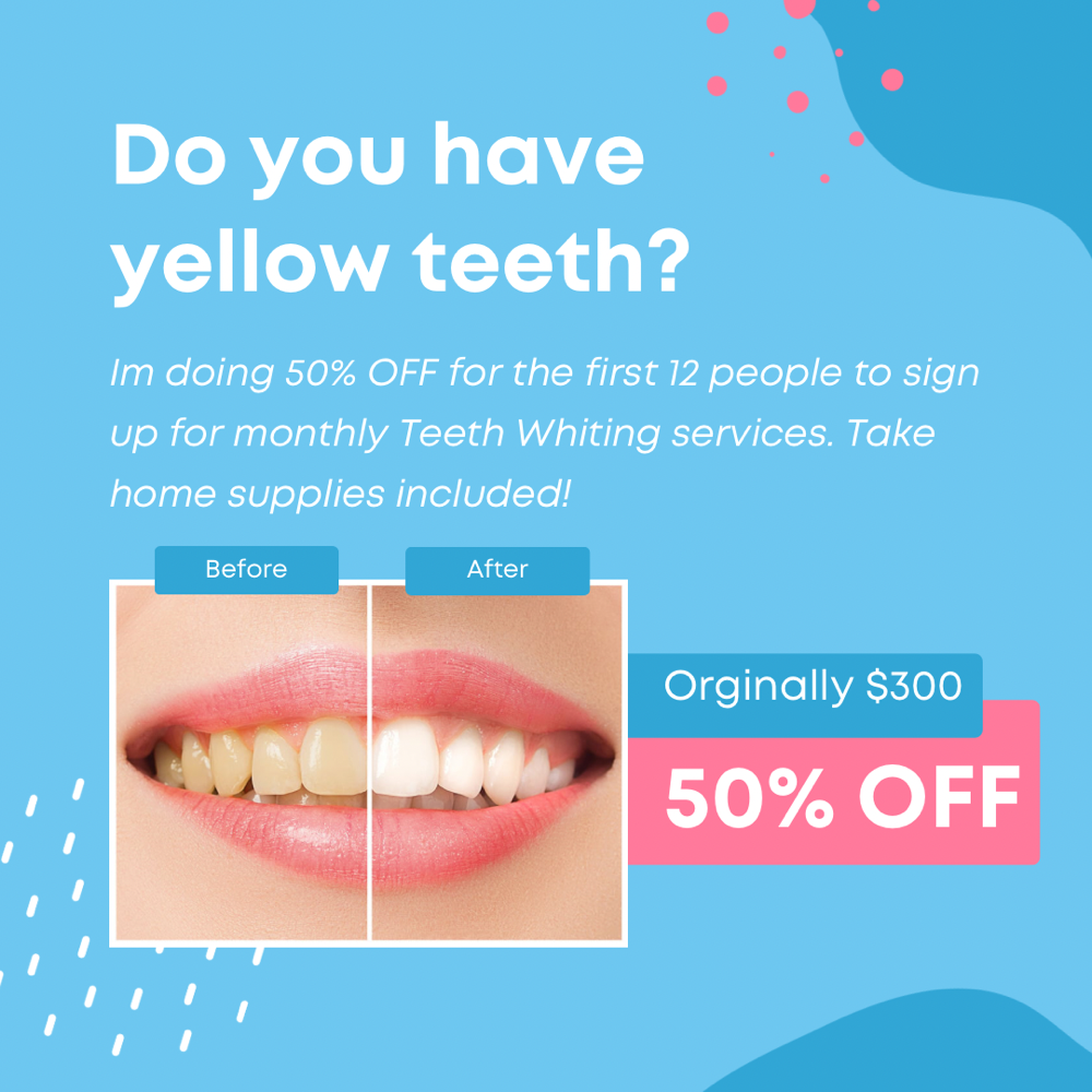 Teeth whiting