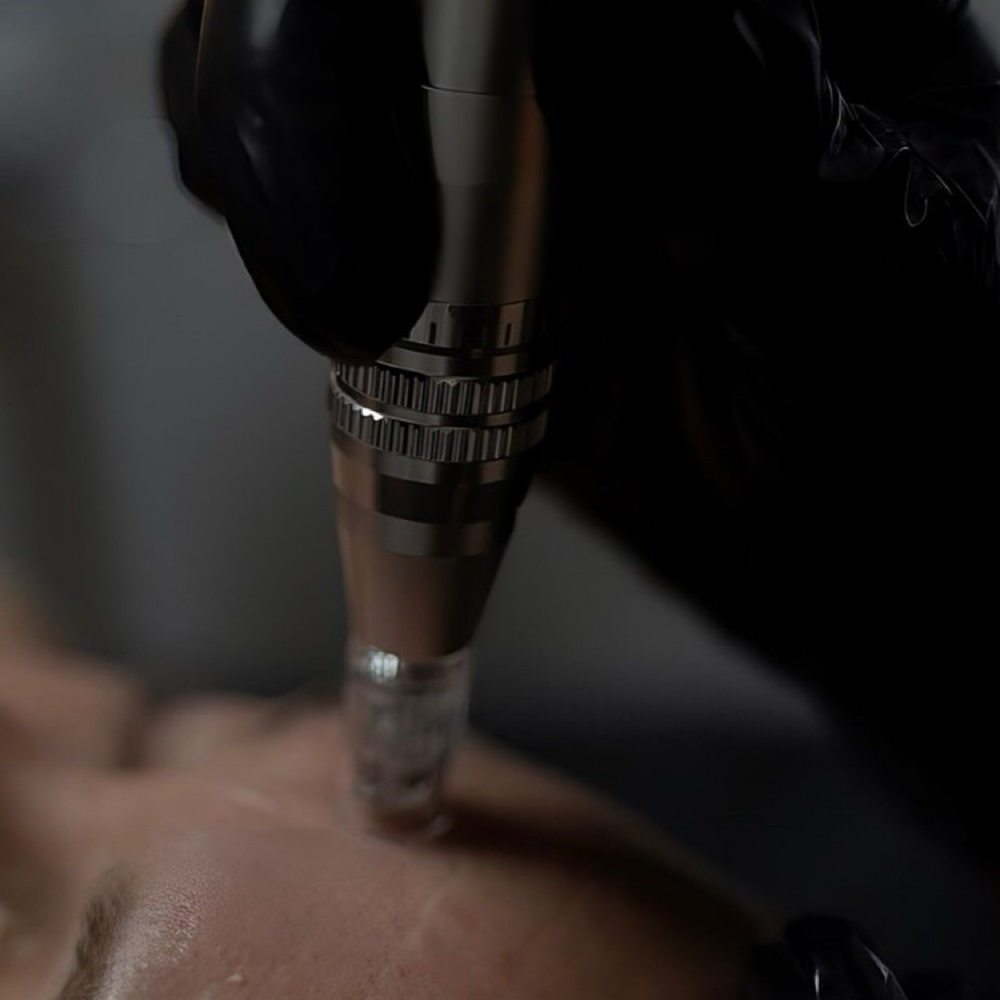 Nano Infusion at Luxxskin in Modesto, CA