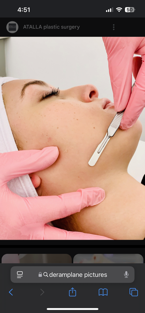 Dermaplane Facial at Pure Elegance Salon & Spa LLC in Sheboygan, WI